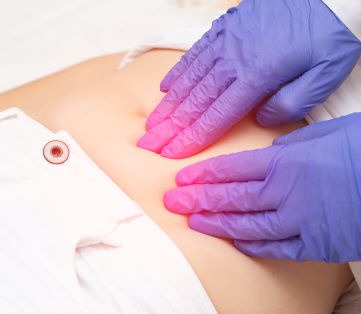 doctor checking abdomen for symptoms of endometriosis