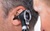 Doctor looking into a patient's ear using a medical ear microscope before ENT surgery